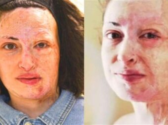 Σαν να μην έγινε ποτέ η επίθεση: Η Ιωάννα Παλιοσπύρου έκρυψε τα σημάδια στο πρόσωπό της με μακιγιάζ και χαμογελά ξανά