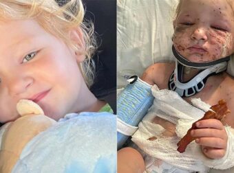 2χρονη Δέχτηκε Φονική Επίθεση Από Τα Κουτάβια Της – Της Έφαγαν Το Αφτί