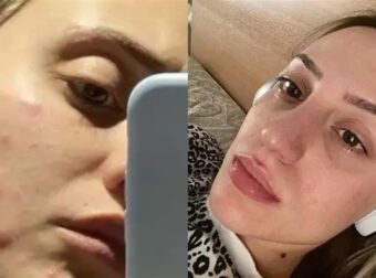Άννα Κορακάκη: «Μου έκαψε το αμάξι, Παλεύω με ψυχοσωματικά νοσήματα και καταθλιπτικά επεισόδια»