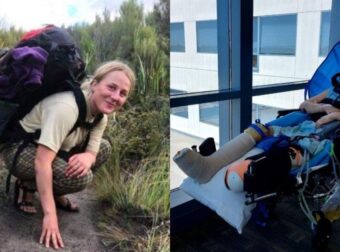 21χρονη έσπασε σχεδόν κάθε κόκαλό της, ακρωτηpιάστηκε & τώρα το νοσοκομείο της ζητά 1,2 εκατ. για έξοδα νοσηλείας