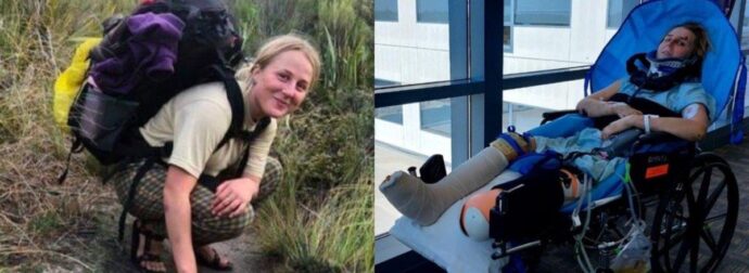 21χρονη έσπασε σχεδόν κάθε κόκαλό της, ακρωτηpιάστηκε & τώρα το νοσοκομείο της ζητά 1,2 εκατ. για έξοδα νοσηλείας