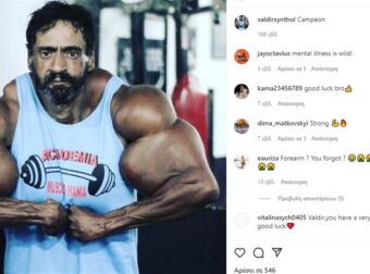 Πέθανε Ο «Βραζιλιάνος Hulk» Ο Άντρας Που Έκανε Ενέσεις Λαδιού Για Να Δημιουργήσει Εξωπραγματικά Μπράτσα (vids)