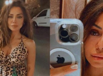 Aυτή είναι η 38χρονη καλλονή που έριξε καυστικό υγρό στον 36χρονο πρώην σύζυγό της