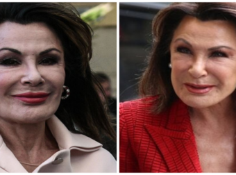 Γιάννα Αγγελοπούλου: Είμαι 66 ετών, τα έχω κάνει όλα, εκτός από λίφτινγκ