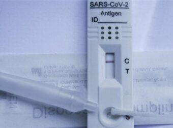 Κορωνοϊός: Τα κρούσματα της χώρας μας για την εβδομάδα 7/11 – 13/11