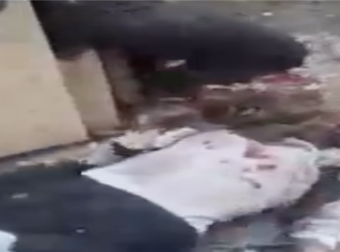 Σκληρές εικόνες απο την Κωνσταντινούπολη – Βίντεο δευτερόλεπτα μετά την έκρηξη. Αίμα παντού