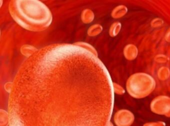 Προσοχή με σηψαιμία: Ποια τα 11 επικίνδυνα συμπτώματα
