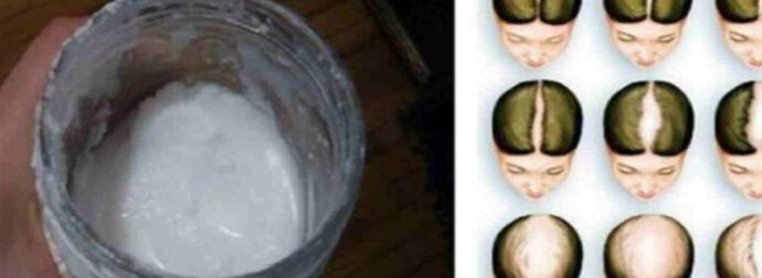 Το άγνωστο μυστικό μαγειρική σόδα: Σώστε τα μαλλιά και κάντε τα να μακρύνουν γρήγορα με αυτό το κόλπο